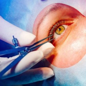 Injecao-intravitrea-1024x627